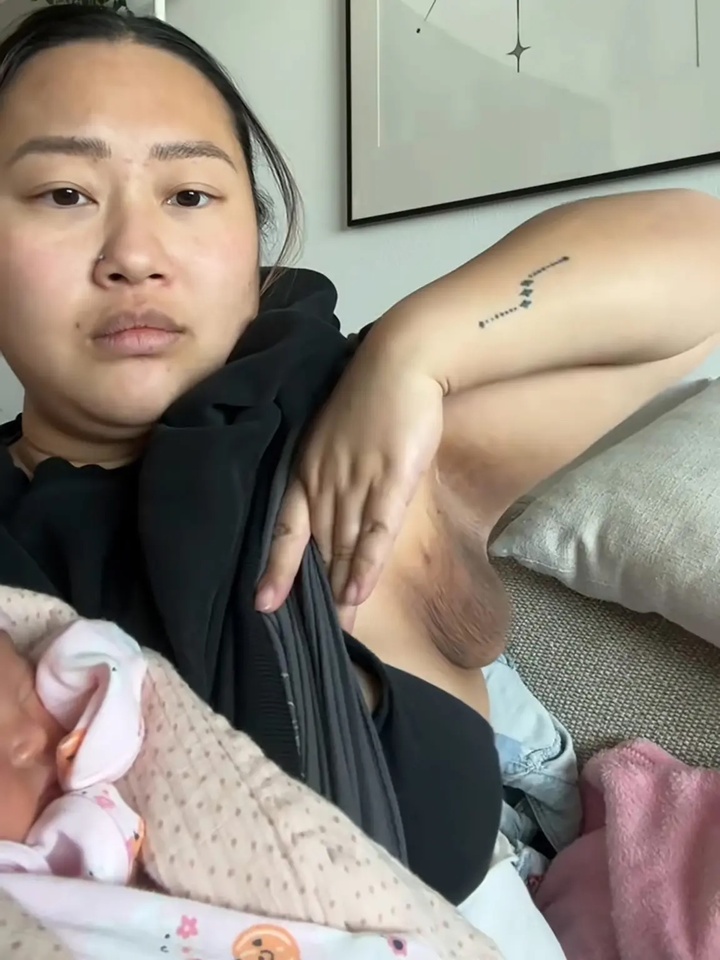 Người phụ nữ mọc th&ecirc;m bầu ngực thứ ba sau khi sinh con, chuy&ecirc;n gia l&yacute; giải- Ảnh 2.