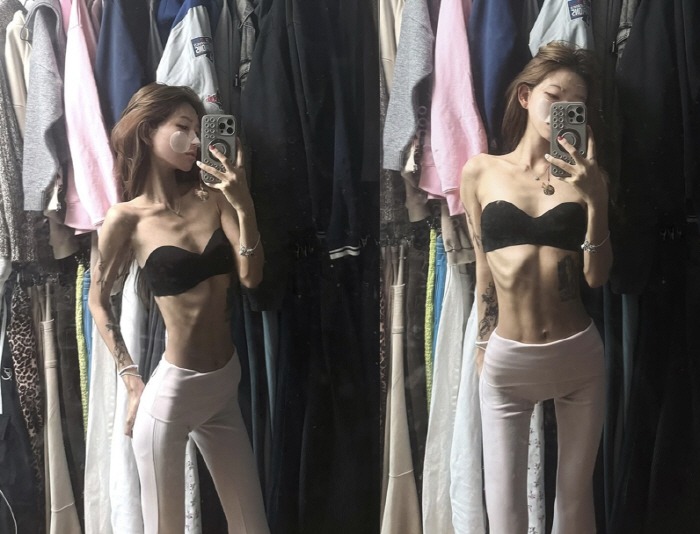 Phát sợ với cơ thể gầy trơ xương, héo mòn của con gái Phát sợ với cơ thể gầy trơ xương, héo mòn của con gái