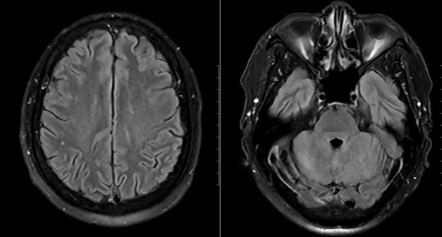 Cảnh báo hệ lụy từ món ăn "lấy may" của nhiều gia đình vào ngày Tết- Ảnh 1. Cảnh báo hệ lụy từ món ăn "lấy may" của nhiều gia đình vào ngày Tết- Ảnh 1.