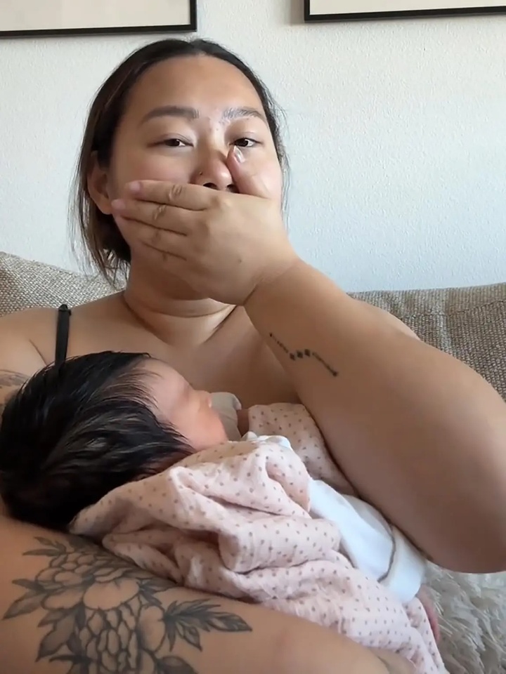 Người phụ nữ mọc th&ecirc;m bầu ngực thứ ba sau khi sinh con, chuy&ecirc;n gia l&yacute; giải- Ảnh 3.