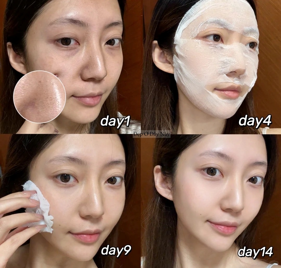 Kh&ocirc;ng cần spa tiền triệu, 28 tuổi t&ocirc;i dưỡng trắng, ngừa n&aacute;m nhờ c&aacute;ch n&agrave;y- Ảnh 6.