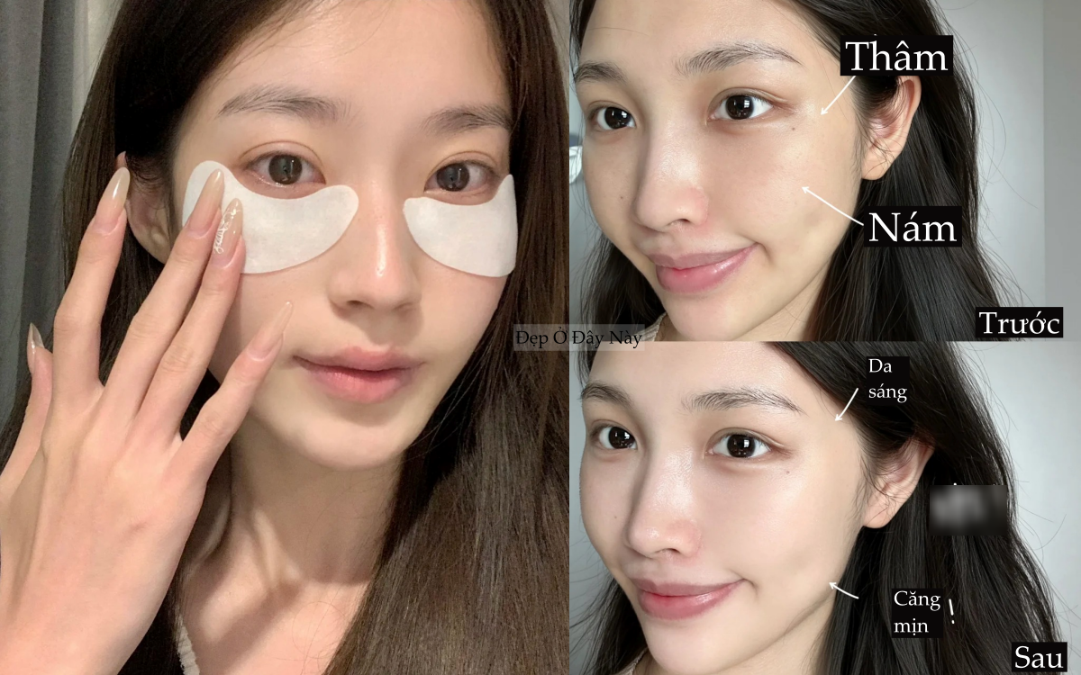 Kh&ocirc;ng cần spa tiền triệu, 28 tuổi t&ocirc;i dưỡng trắng, ngừa n&aacute;m nhờ c&aacute;ch n&agrave;y- Ảnh 1.