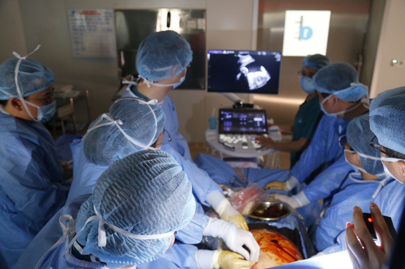 Cứu sống b&agrave;o thai dị tật tim rất nặng ngay trong bụng mẹ- Ảnh 2.