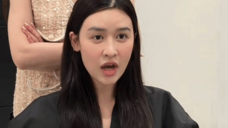 Quy&ecirc;n Qui tu sửa gương mặt- Ảnh 2.