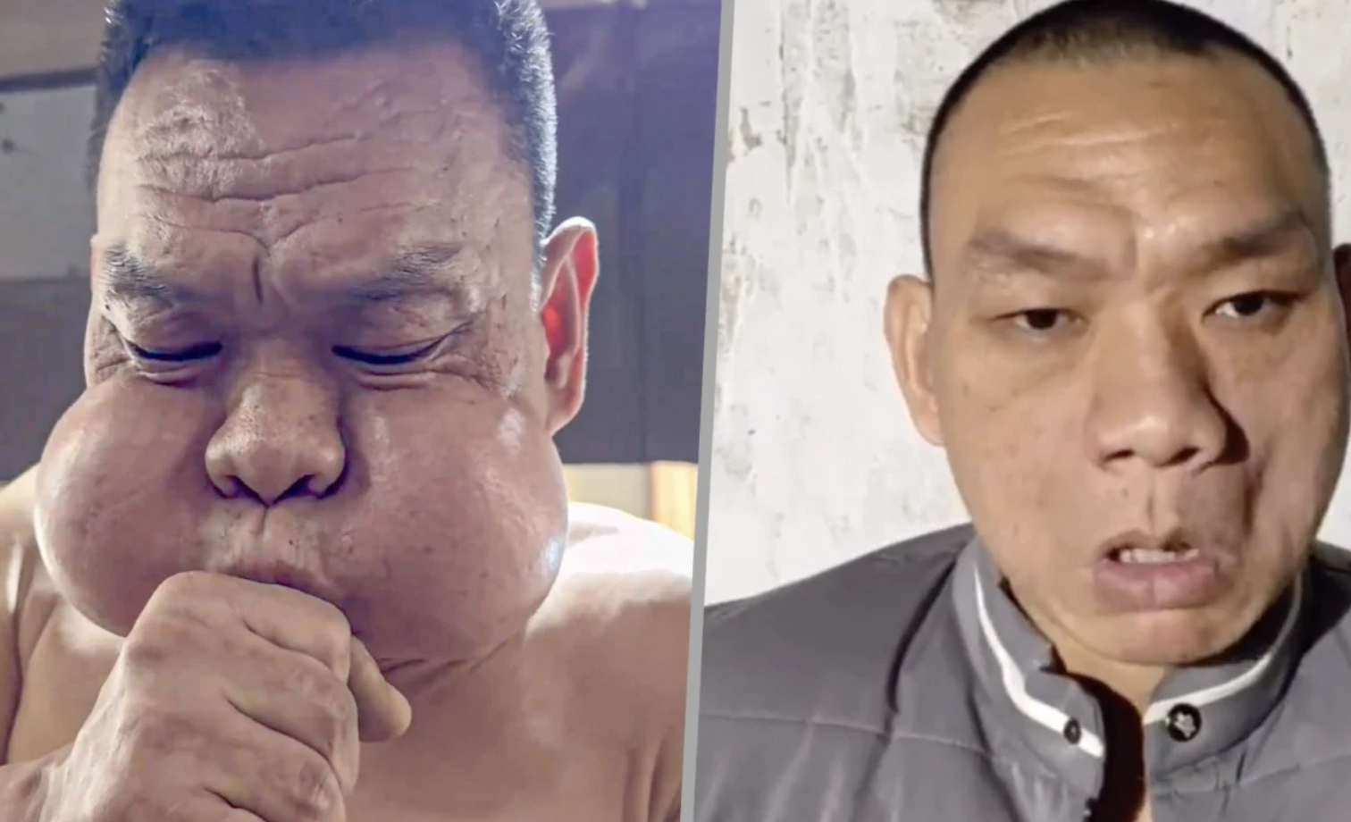 30 năm thổi thủy tinh, gương mặt biến dạng: Nghệ nh&acirc;n Trung Quốc c&oacute; đ&ocirc;i m&aacute; phồng như &ldquo;ếch&rdquo;, c&aacute;i gi&aacute; kh&ocirc;ng ai muốn trả- Ảnh 2.