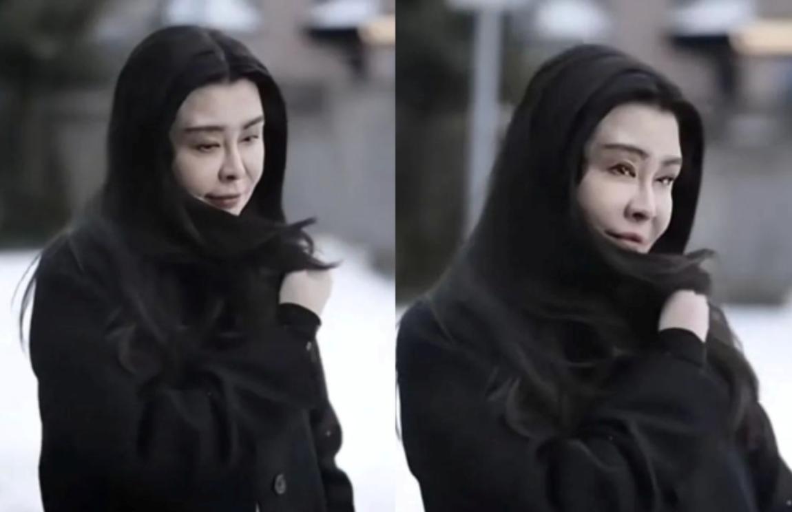 Gương mặt biến dạng th&ecirc; thảm của mỹ nh&acirc;n sở hữu nhan sắc "khiến cả thi&ecirc;n hạ quỳ phục"- Ảnh 3.