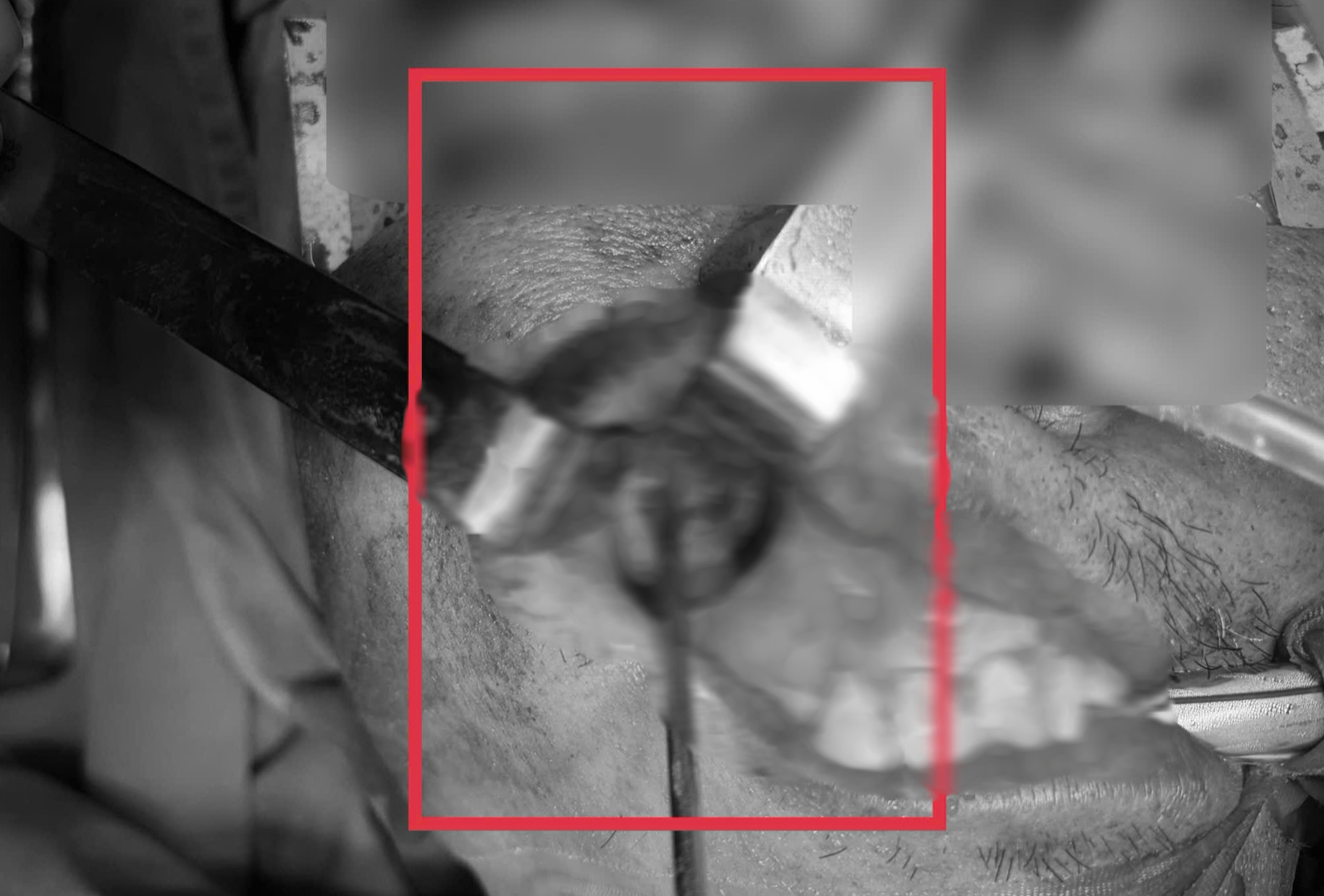 Nấm đen ăn m&ograve;n xoang h&agrave;m người đ&agrave;n &ocirc;ng khỏe mạnh- Ảnh 1.