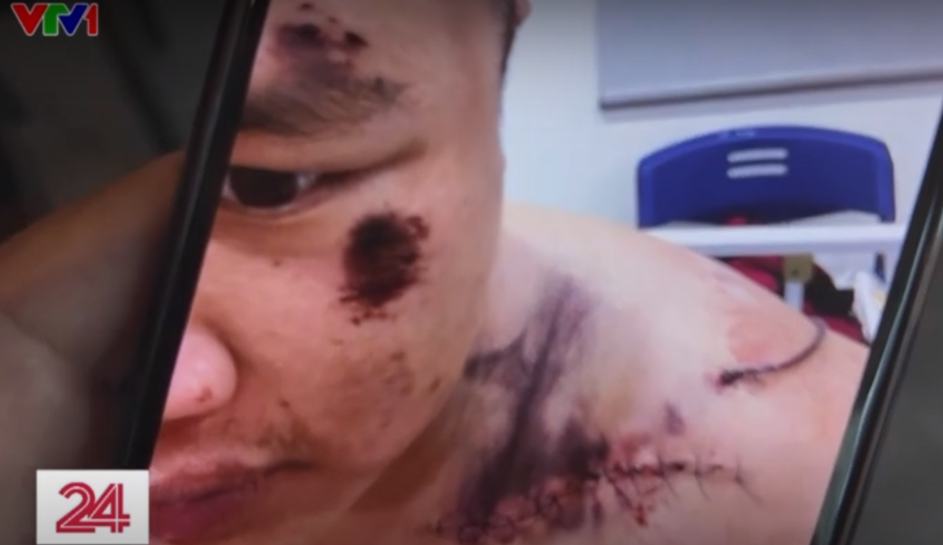 &ldquo;Gậy Hạ Long&rdquo; v&agrave; nỗi kinh ho&agrave;ng của những đứa trẻ tại Trung t&acirc;m c&ocirc;ng t&aacute;c x&atilde; hội Hải H&agrave;- Ảnh 6.