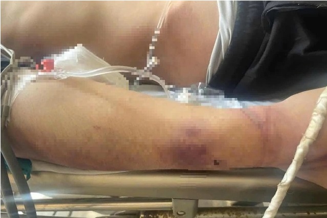 Bắt giam Giám đốc Nguyễn Văn Hải: Hành động bất thường của Trung tâm CTXH Hải Hà sau khi học viên tử vong- Ảnh 2. Bắt giam Giám đốc Nguyễn Văn Hải: Hành động bất thường của Trung tâm CTXH Hải Hà sau khi học viên tử vong- Ảnh 2.