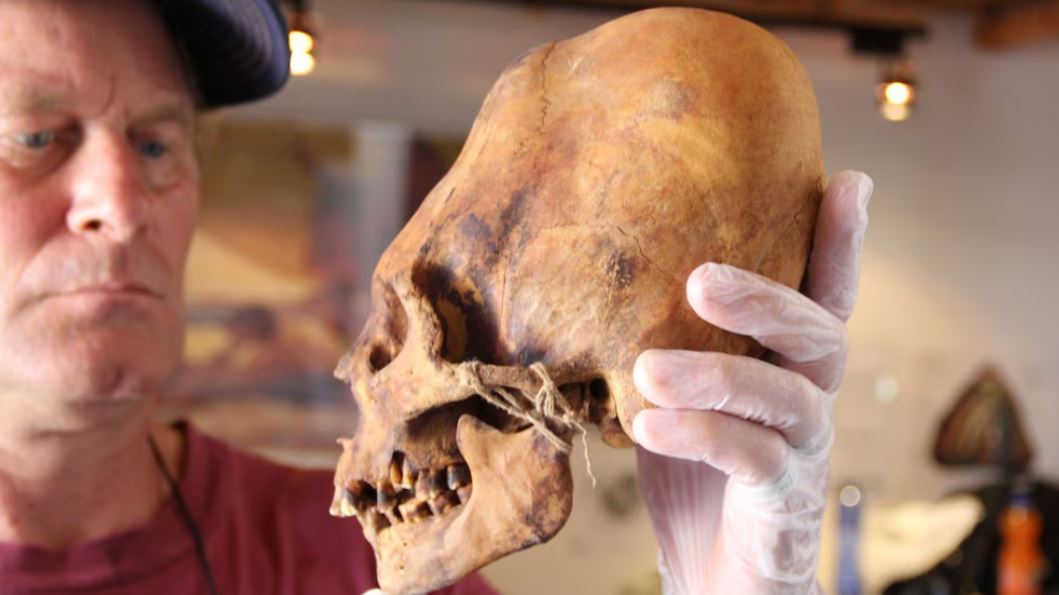 Giải mã sọ Paracas: Kết quả ADN sơ bộ hé lộ khác biệt gây chấn động với hộp sọ người hiện đại- Ảnh 1. Giải mã sọ Paracas: Kết quả ADN sơ bộ hé lộ khác biệt gây chấn động với hộp sọ người hiện đại- Ảnh 1.