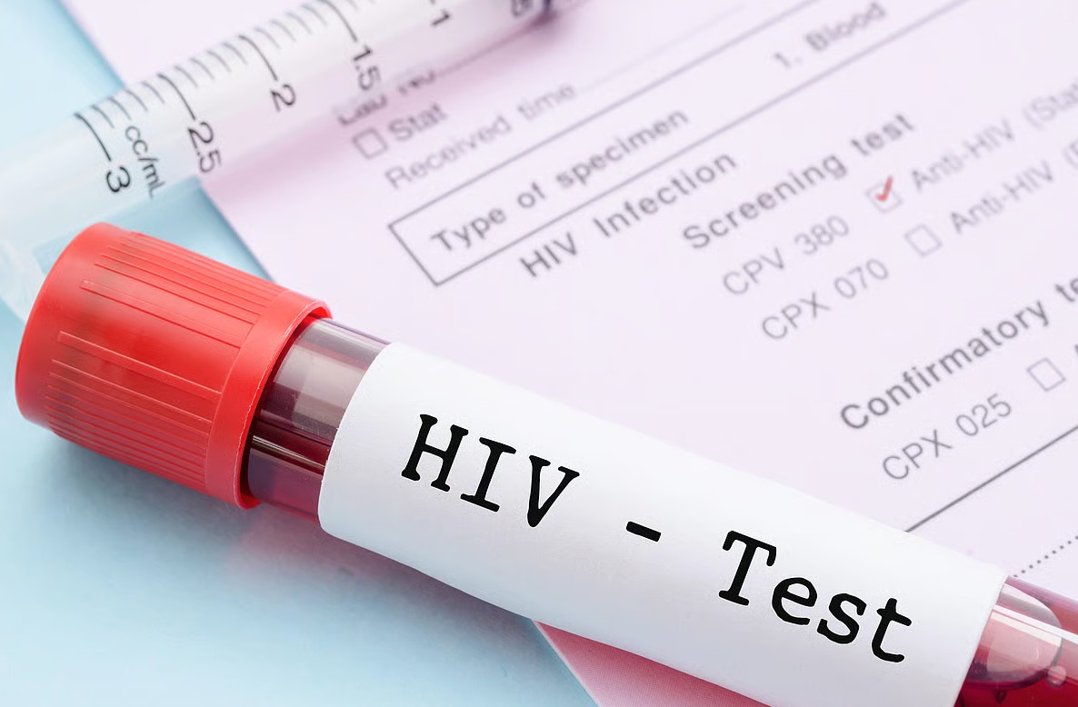 1 th&agrave;nh phố ghi nhận hơn 3.000 ca nhiễm HIV mới trong 9 th&aacute;ng đầu năm 2025: 81% l&acirc;y qua con đường n&agrave;y- Ảnh 1.