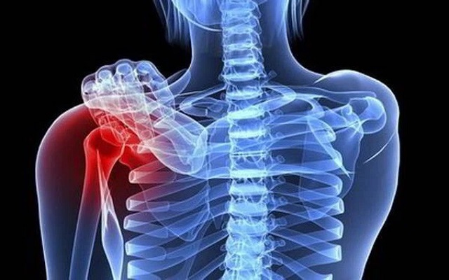 Cơn ho tưởng v&ocirc; hại của cậu b&eacute; 15 tuổi v&agrave; chẩn đo&aacute;n khiến cả gia đ&igrave;nh sụp đổ- Ảnh 4.