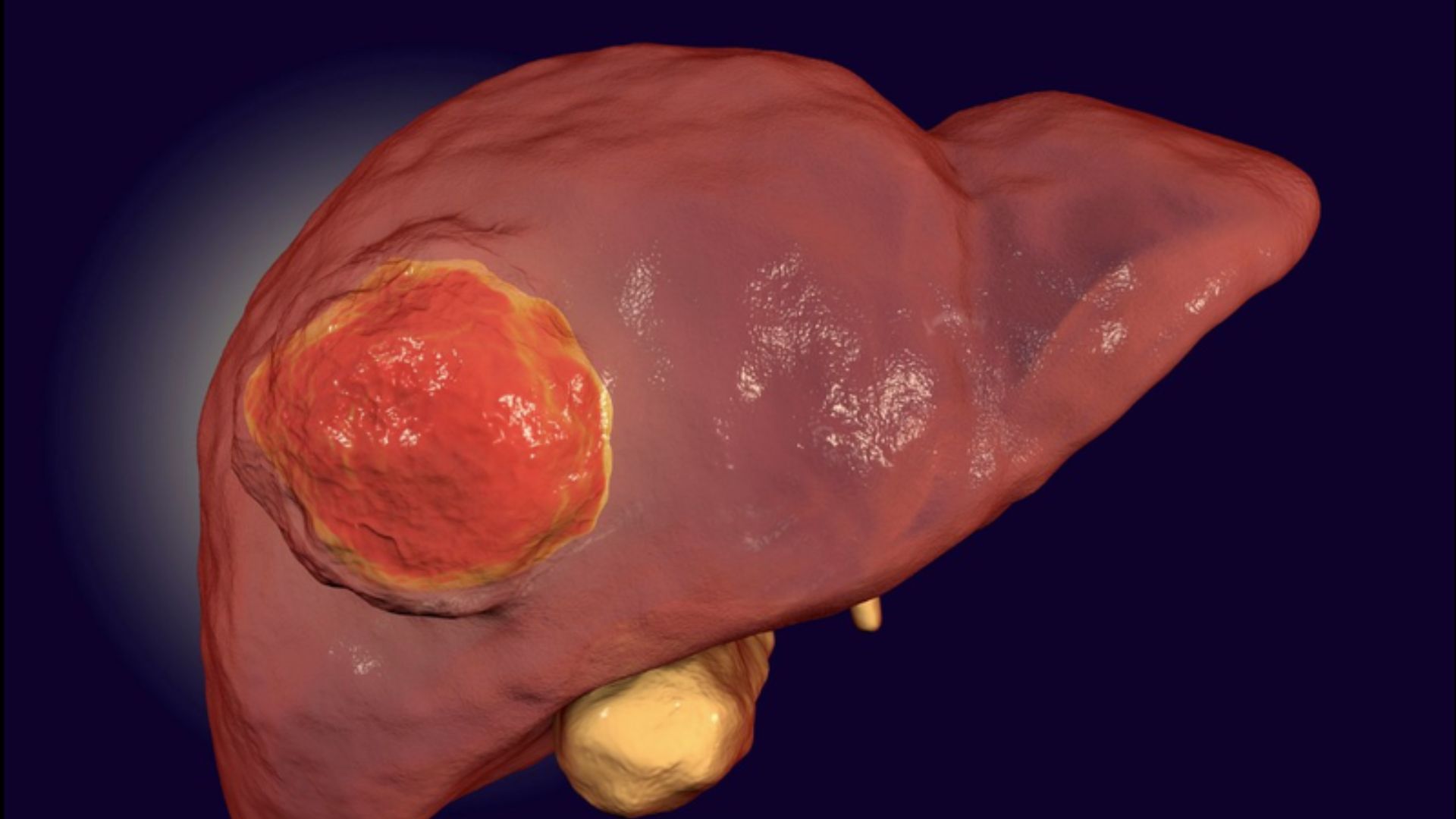 B&aacute;c sĩ chỉ ra 5 th&oacute;i quen ăn uống nu&ocirc;i 