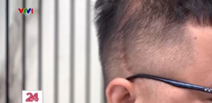 Theo t&ocirc;i, đ&acirc;y l&agrave; chi tiết Đ&Aacute;NG SỢ nhất trong vụ Trung t&acirc;m Hải H&agrave; bạo h&agrave;nh trẻ!- Ảnh 1.