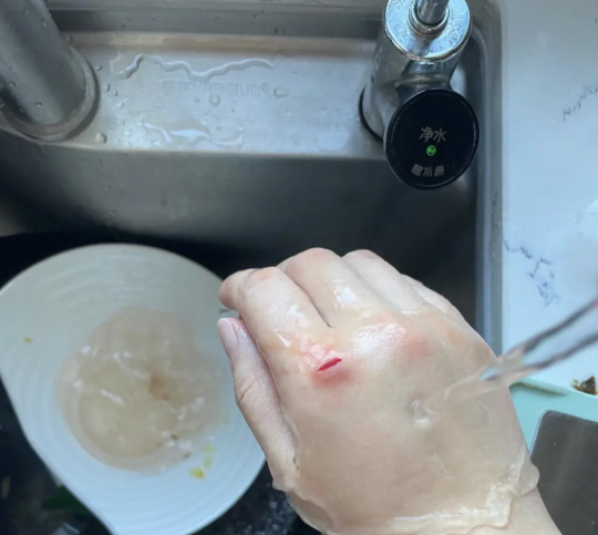 Người ngh&egrave;o chấp niệm 7 thứ 