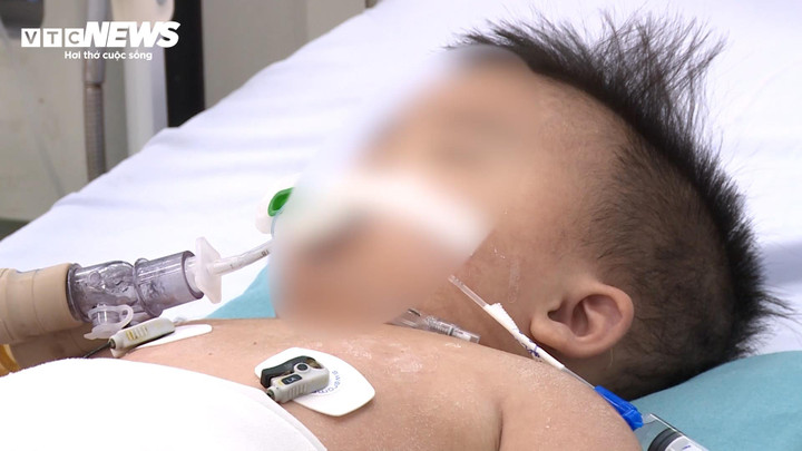 B&aacute;c sĩ chỉ c&aacute;ch ph&ograve;ng bệnh cho trẻ nhỏ thời điểm giao m&ugrave;a- Ảnh 2.