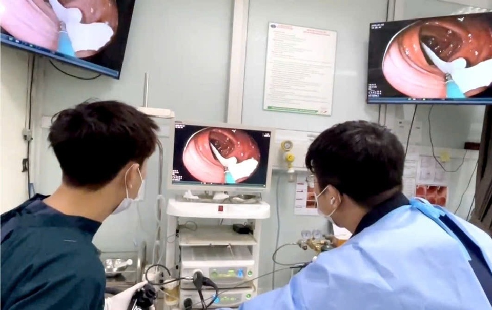 Người đ&agrave;n &ocirc;ng 35 tuổi sốc nặng khi thấy k&yacute; sinh tr&ugrave;ng "khổng lồ" đang sống trong ruột- Ảnh 1.