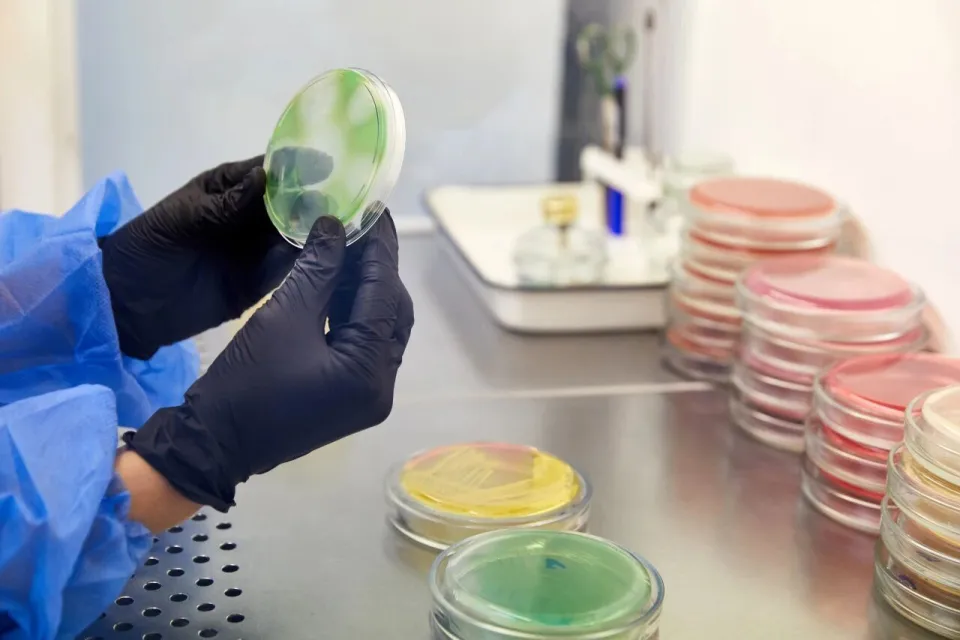 Kh&ocirc;ng chỉ sữa bột, nhiều thực phẩm quen thuộc cũng c&oacute; thể chứa vi khuẩn Bacillus cereus - thứ khiến Nestl&eacute; thu hồi sữa to&agrave;n cầu- Ảnh 4.