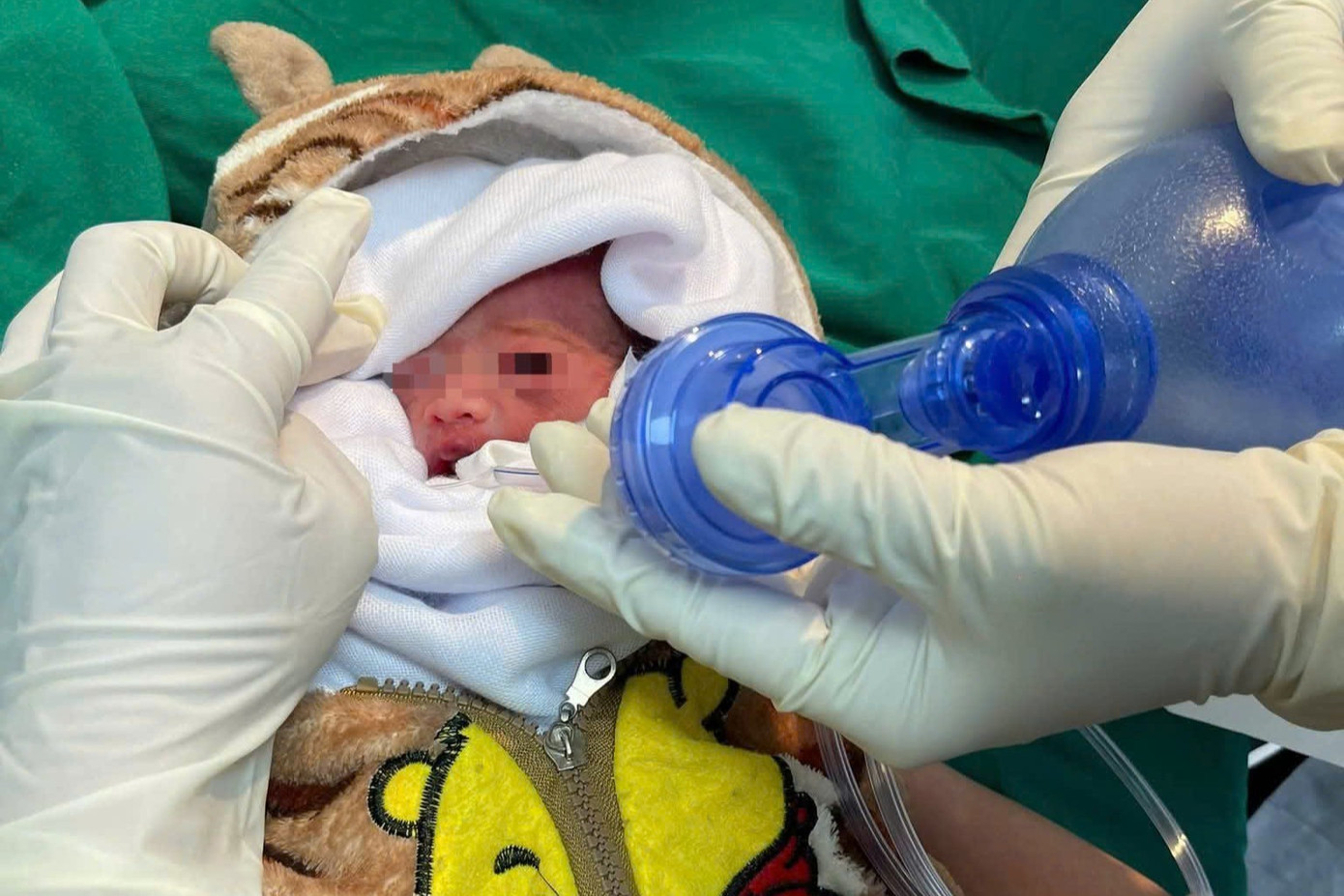 Gi&agrave;nh giật sự sống cho trẻ sinh non chỉ nặng 900 gram- Ảnh 2.