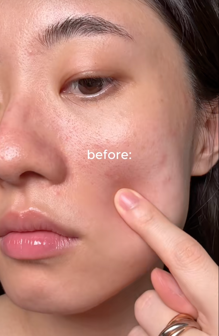 D&ugrave;ng retinol m&ugrave;a thu đ&ocirc;ng, da bị kh&ocirc; hơn b&igrave;nh thường: Đấy l&agrave; bạn chưa biết đến hũ kem kh&oacute;a ẩm chỉ v&agrave;i chục ngh&igrave;n n&agrave;y- Ảnh 6.