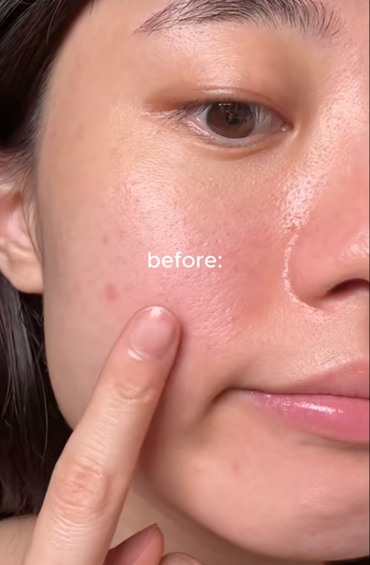 D&ugrave;ng retinol m&ugrave;a thu đ&ocirc;ng, da bị kh&ocirc; hơn b&igrave;nh thường: Đấy l&agrave; bạn chưa biết đến hũ kem kh&oacute;a ẩm chỉ v&agrave;i chục ngh&igrave;n n&agrave;y- Ảnh 1.