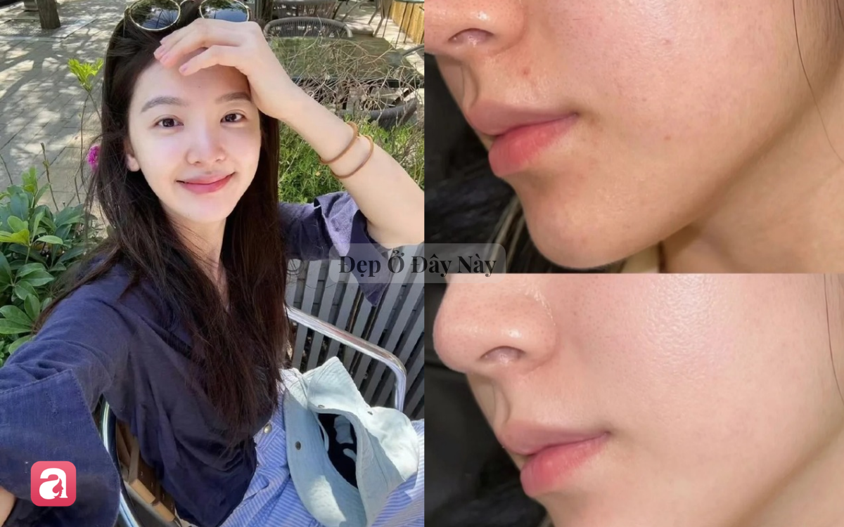 Vì sao da lão hóa và mất collagen nhanh, lộ rõ nếp nhăn vào mùa thu? - Ảnh 2.