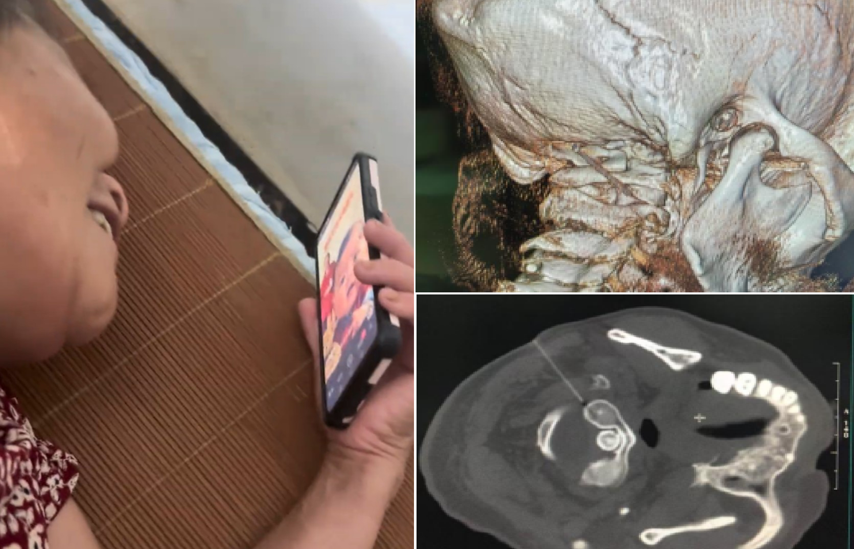 Nghiện xem phim ngắn &ldquo;tr&ugrave;ng sinh, tổng t&agrave;i&rdquo;, người phụ nữ 57 tuổi đầu đau &ldquo;như b&uacute;a bổ&rdquo; - Ảnh 2.