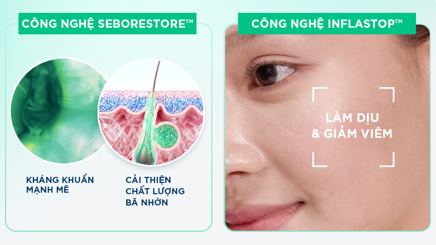 Bạn có biết: Chất lượng bã nhờn cũng ảnh hưởng đến tình trạng mụn trên da? - Ảnh 1.