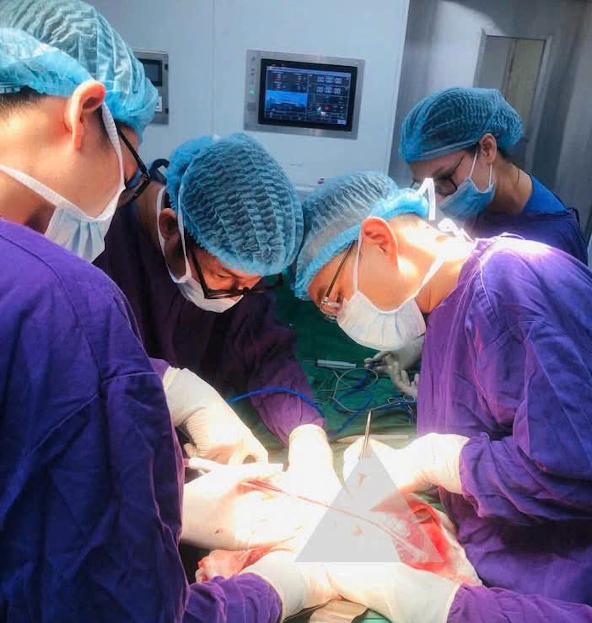 Bụng to bất thường, người đ&agrave;n &ocirc;ng sốc khi b&aacute;c sĩ gắp ra thứ "đ&aacute;ng sợ" nặng 2kg b&ecirc;n trong - Ảnh 1.
