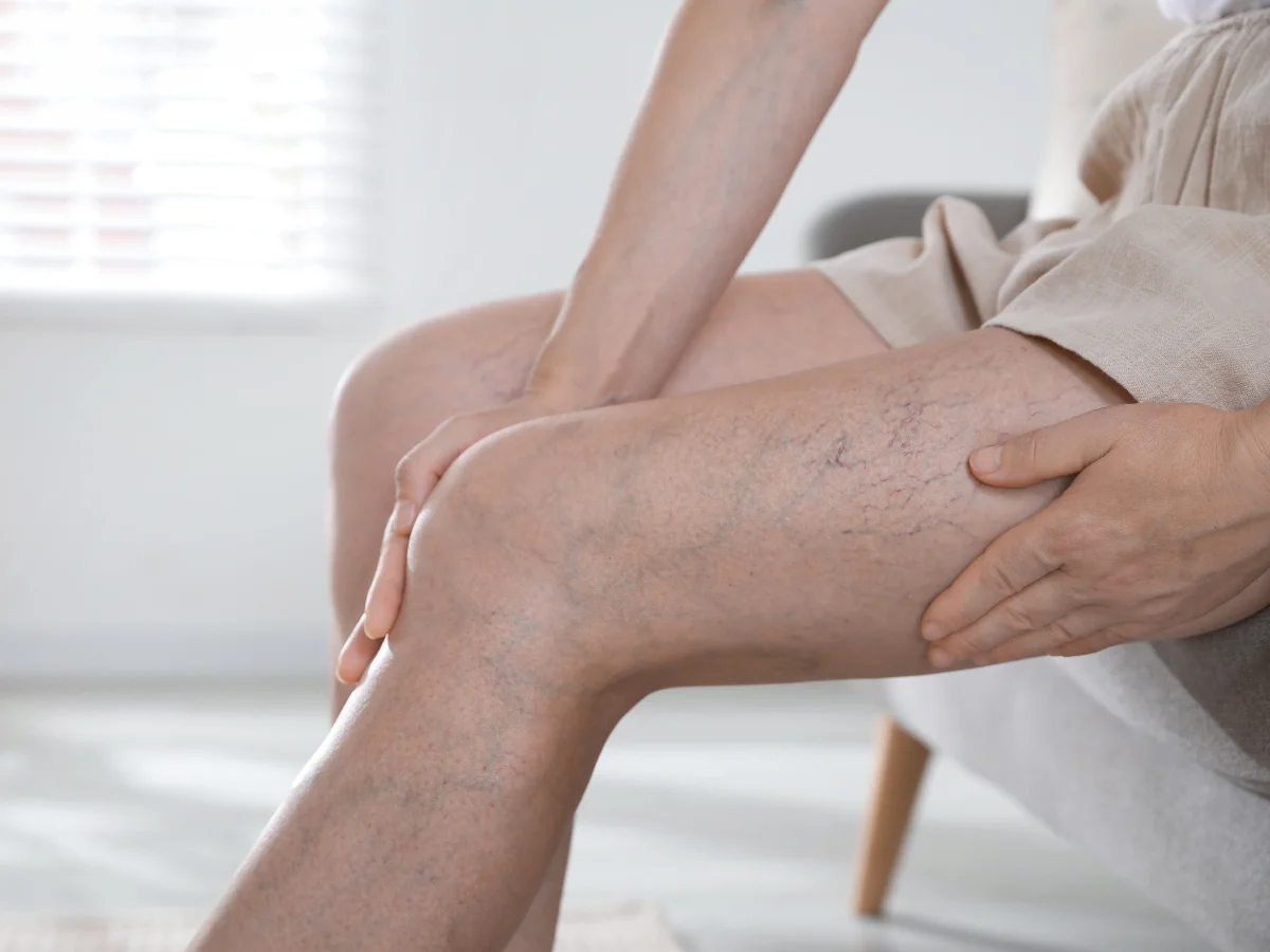 Bị gi&atilde;n tĩnh mạch ở tuổi 30: Chuy&ecirc;n gia Nhật hướng dẫn c&aacute;ch bảo vệ đ&ocirc;i ch&acirc;n chỉ với 3 ph&uacute;t, ai hay ngồi hoặc đứng trong thời gian d&agrave;i n&ecirc;n học - Ảnh 1.