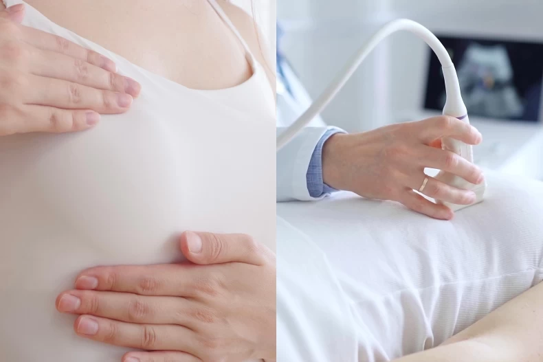 Nữ b&aacute;c sĩ được chẩn đo&aacute;n mắc "ung thư v&uacute; nguy hiểm nhất" đ&atilde; nhấn mạnh "th&oacute;i quen" su&yacute;t cướp đi mạng sống của m&igrave;nh - Ảnh 1.