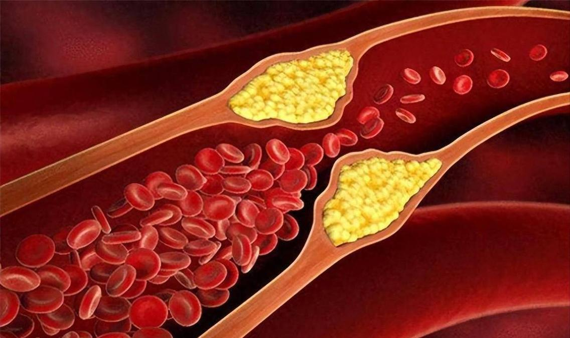2 thực phẩm n&agrave;y l&agrave;m tăng lượng mỡ trong m&aacute;u mạnh hơn cả thịt chi&ecirc;n r&aacute;n, nhiều người ăn ch&uacute;ng mỗi ng&agrave;y m&agrave; kh&ocirc;ng hề nhận ra - Ảnh 5.