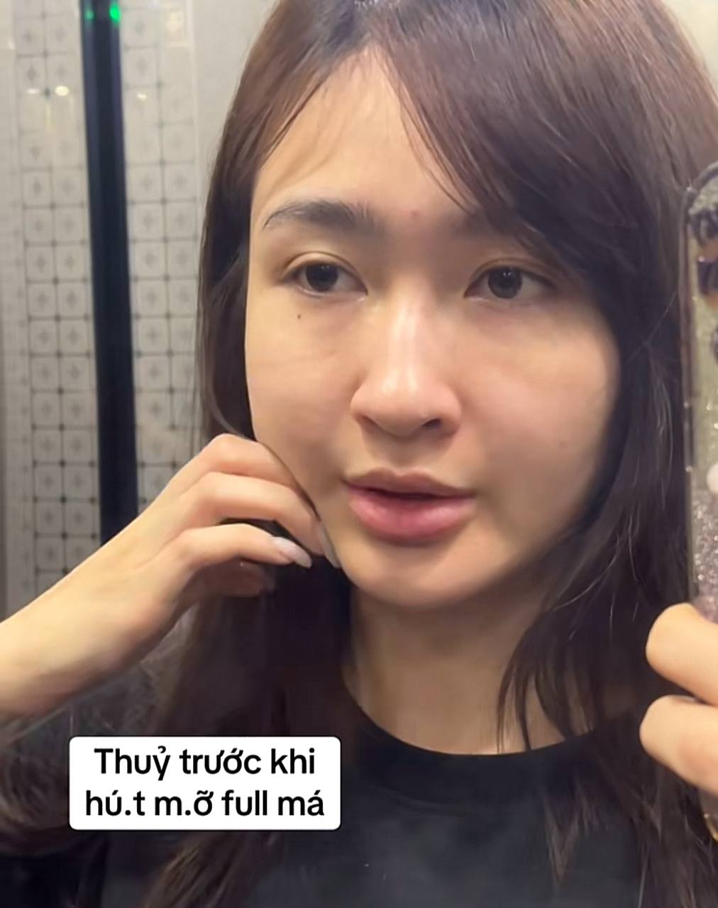 Mỹ nh&acirc;n SN 2001 đ&oacute;ng phim giờ v&agrave;ng VTV c&ocirc;ng khai dung mạo sau khi h&uacute;t mỡ mặt- Ảnh 2.