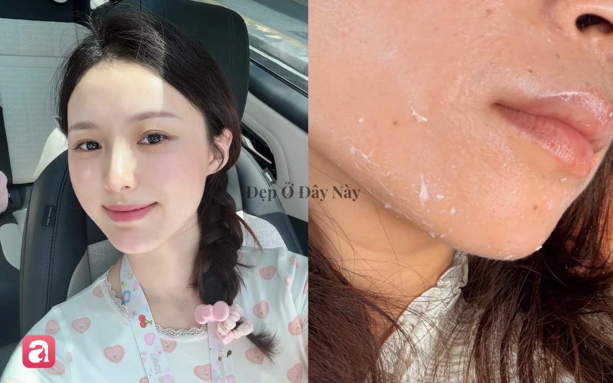Vì sao thoa kem chống nắng hay bị vón cục và để lại vệt trắng trên da vào mùa thu?- Ảnh 1.
