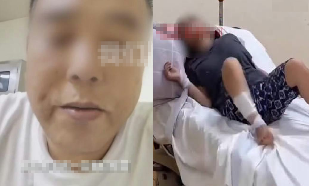 Người đ&agrave;n &ocirc;ng qua đời sau 47 ng&agrave;y V&igrave; kh&ocirc;ng ti&ecirc;m vaccine dại khi bị ch&oacute; cắn - Ảnh 1.