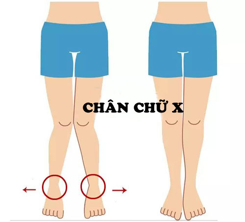 Kiểu dáng chân