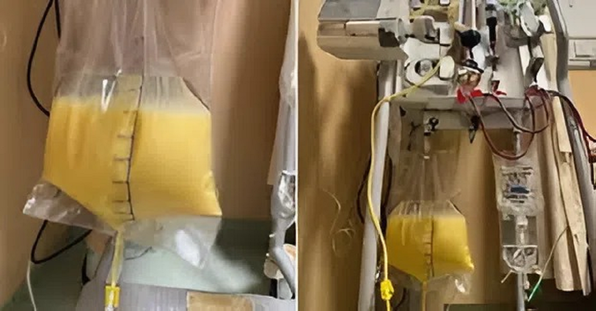 Người phụ nữ 32 tuổi "m&aacute;u trắng như sữa", b&aacute;c sĩ chỉ mặt điểm t&ecirc;n th&oacute;i quen &iacute;t ai ngờ - Ảnh 1.