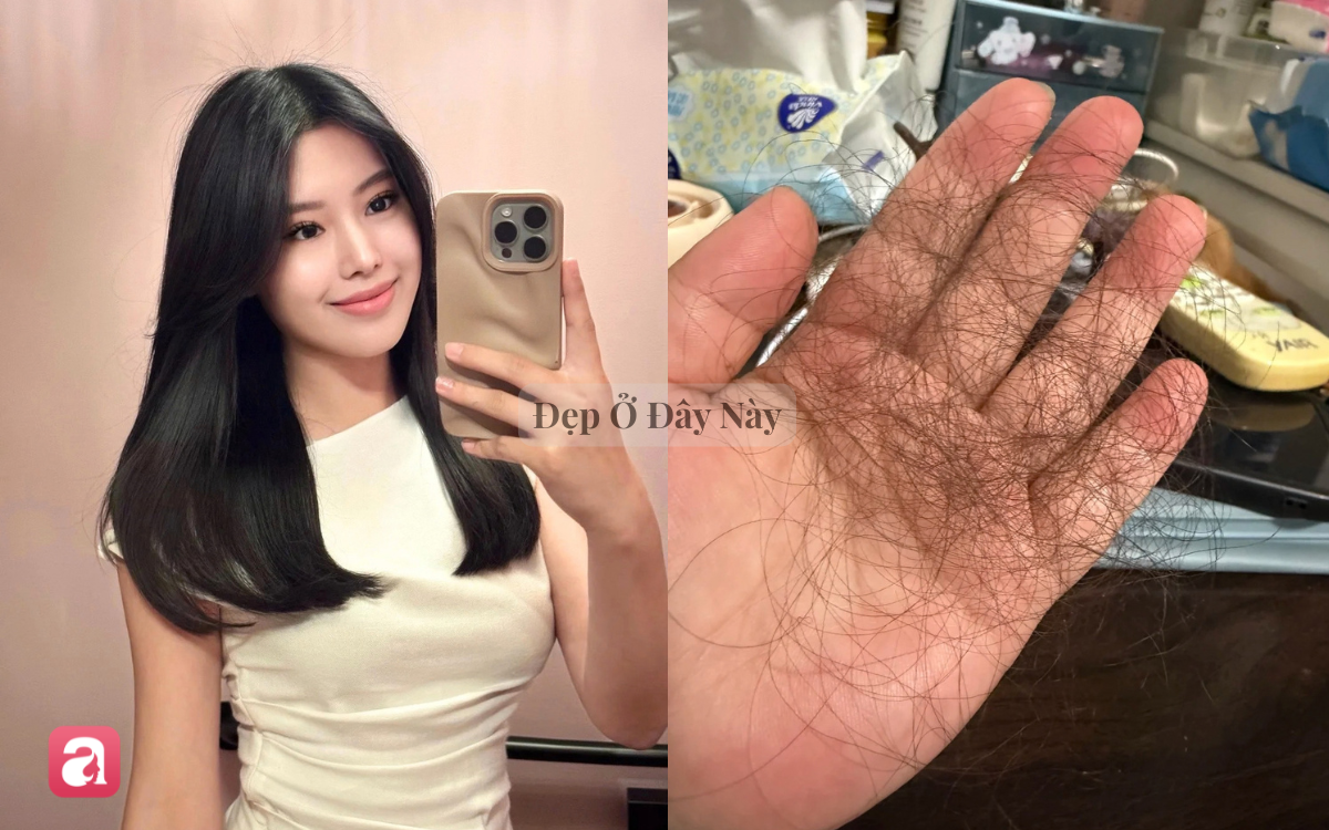 V&igrave; sao nhiều người chăm t&oacute;c c&agrave;ng kỹ, t&oacute;c c&agrave;ng g&atilde;y rụng nhiều?- Ảnh 2.