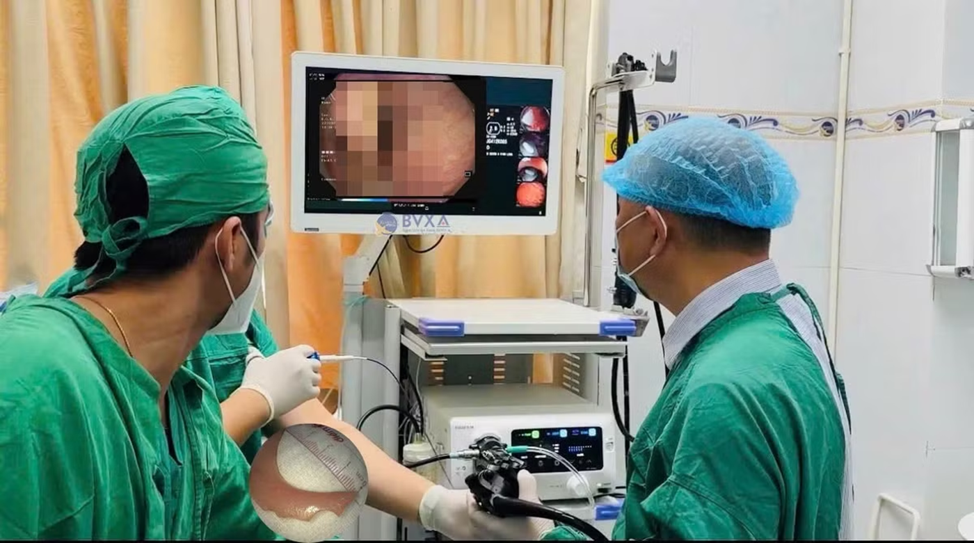 Người đ&agrave;n &ocirc;ng 51 tuổi uống nước, bất ngờ nuốt nhầm thứ "kh&ocirc;ng thể tin nổi" - Ảnh 1.