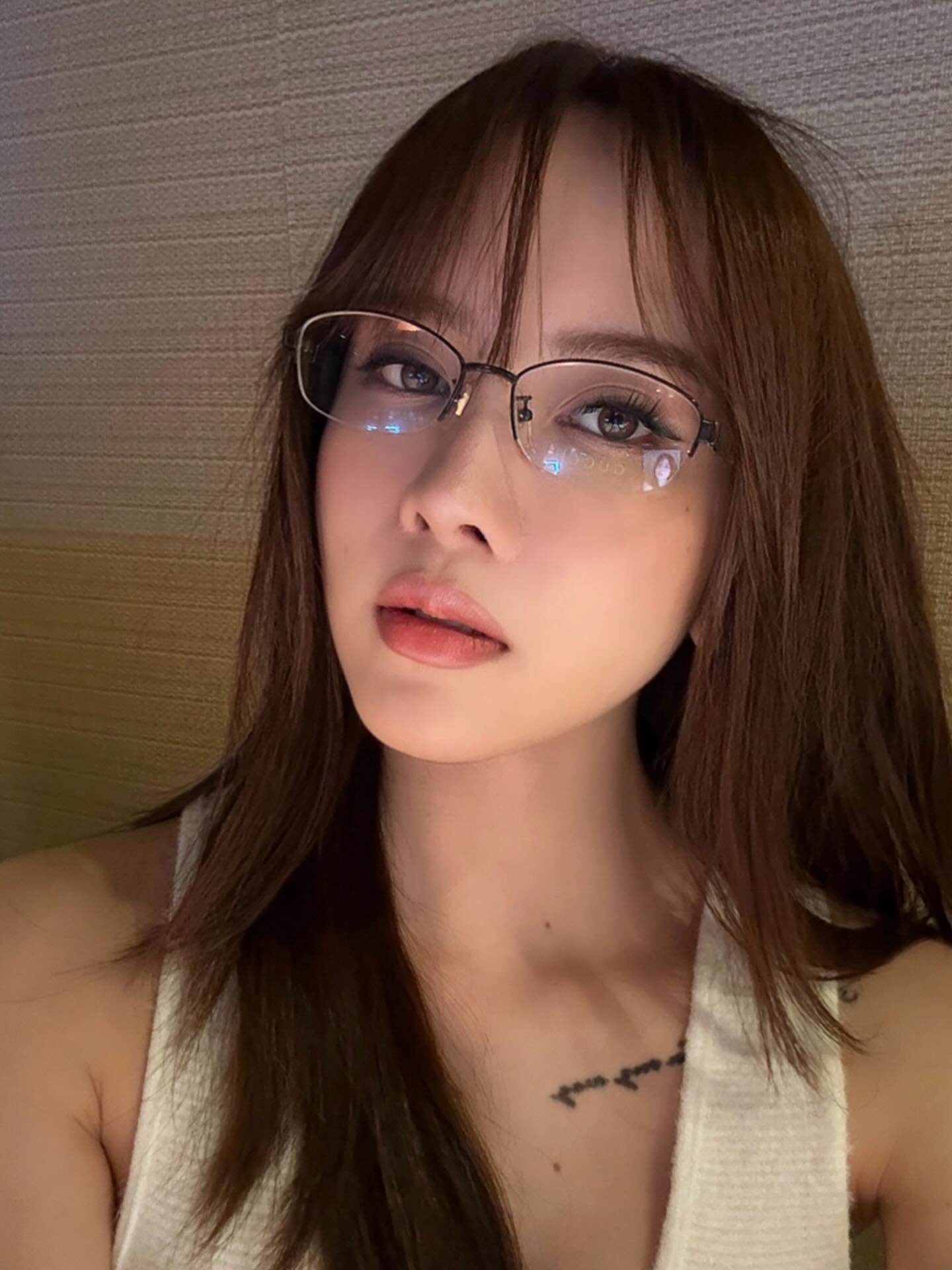 Gương mặt nhiều di chứng thẩm mỹ của Thiều Bảo Tr&acirc;m đang khiến nhiều người lo lắng- Ảnh 4.