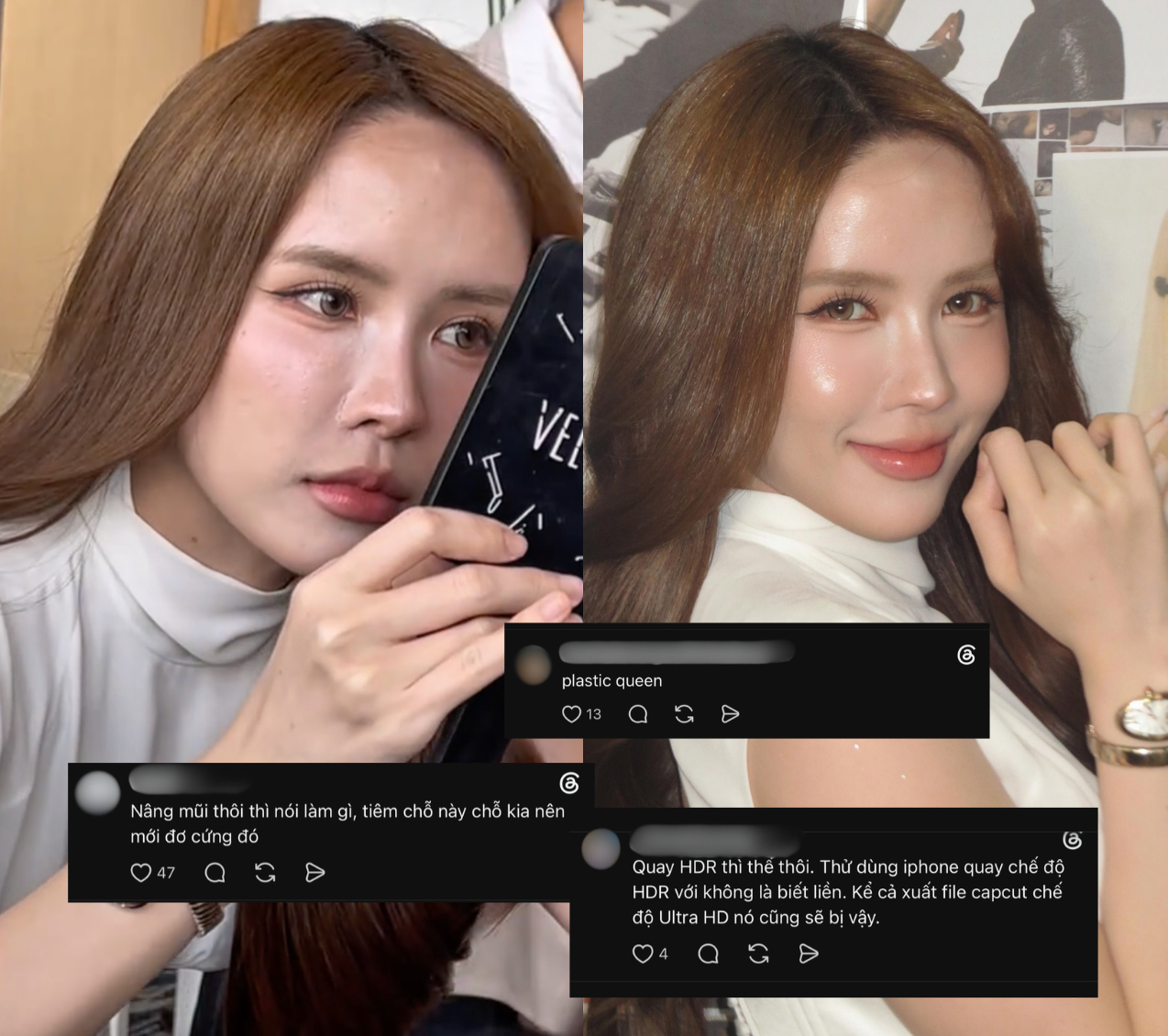Gương mặt nhiều di chứng thẩm mỹ của Thiều Bảo Tr&acirc;m đang khiến nhiều người lo lắng- Ảnh 2.