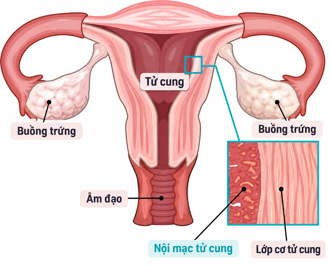 Sau m&atilde;n kinh thấy d&ugrave; chỉ 1 dấu hiệu n&agrave;y cũng đừng chủ quan: C&oacute; thể l&agrave; dấu hiệu ung thư đang &acirc;m thầm tiến triển- Ảnh 4.