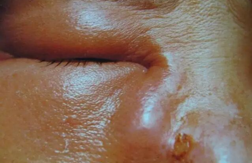 Sáng ngủ dậy nước mắt “dính như keo”, người phụ nữ đi khám phát hiện điều bất ngờ - Ảnh 1.