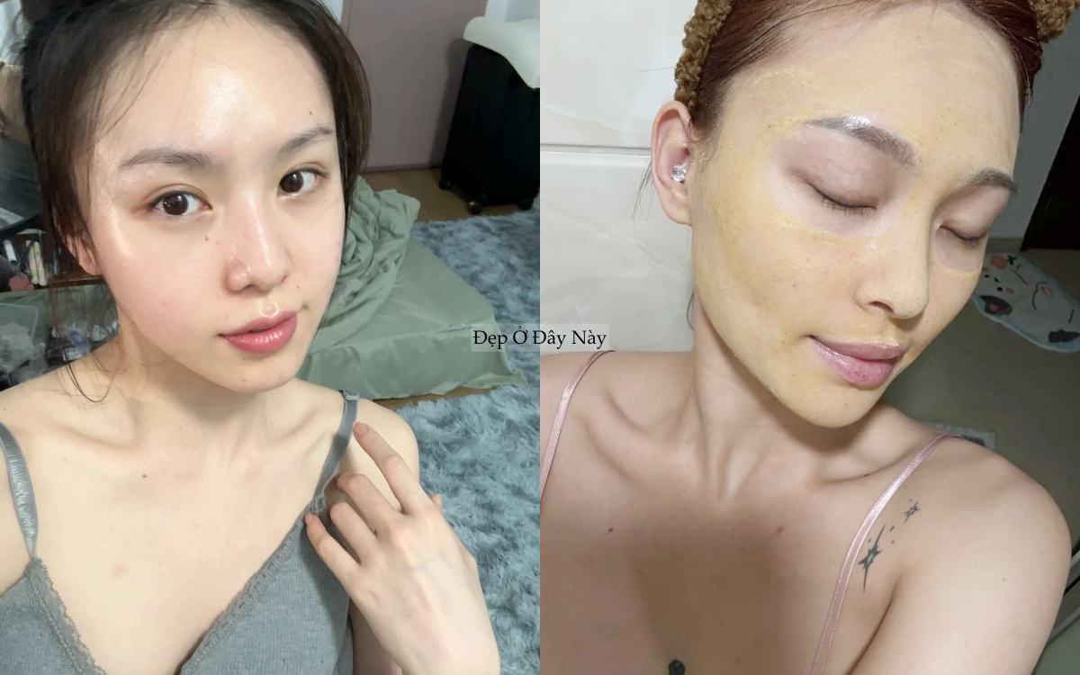 Da sạch mụn, mờ th&acirc;m nhờ 5 m&oacute;n dưỡng da từ nghệ chất lượng- Ảnh 1.
