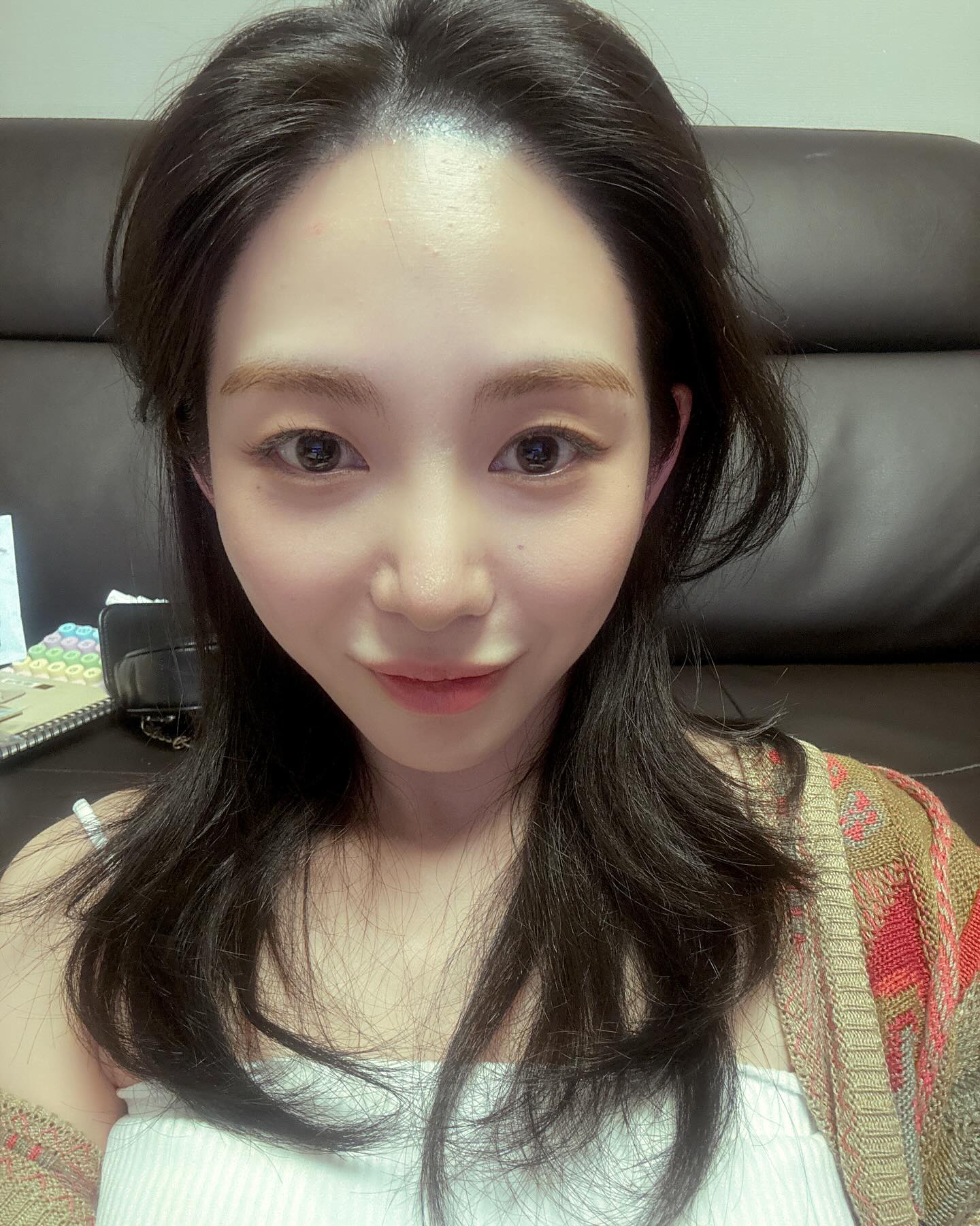 Nữ ca sĩ mất Tết, bị bỏng nặng một b&ecirc;n mặt khi đi l&agrave;m đẹp- Ảnh 4.