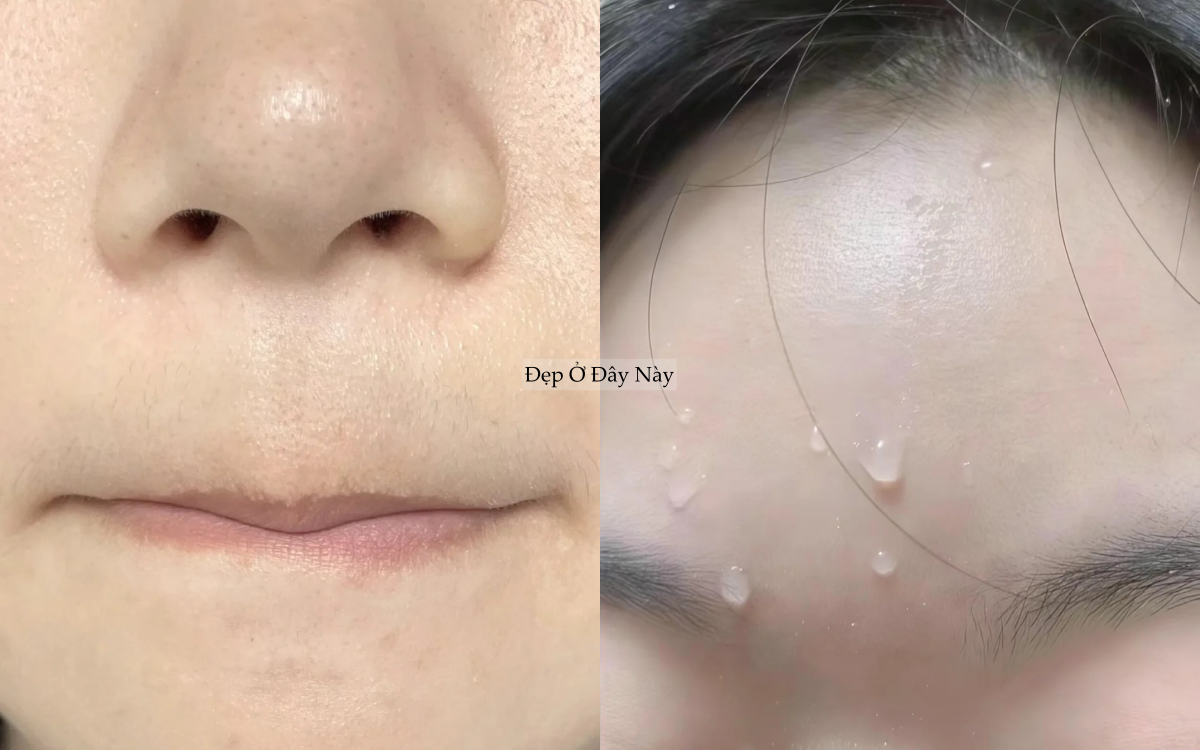 Kh&ocirc;ng d&ugrave;ng mỹ phẩm đắt tiền, tuổi 25 t&ocirc;i thu nhỏ lỗ ch&acirc;n l&ocirc;ng của m&igrave;nh nhờ 4 bước n&agrave;y!- Ảnh 3.