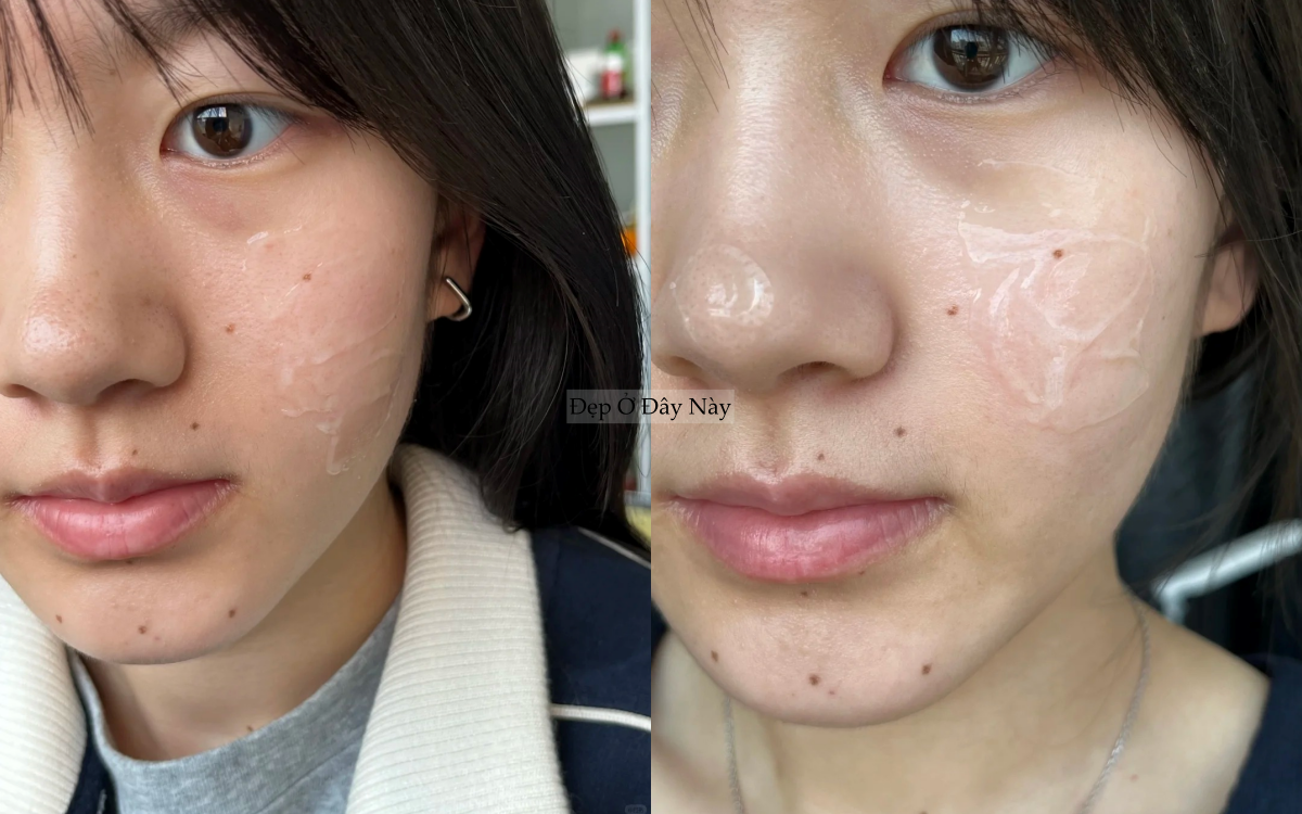 Kh&ocirc;ng d&ugrave;ng mỹ phẩm đắt tiền, tuổi 25 t&ocirc;i thu nhỏ lỗ ch&acirc;n l&ocirc;ng của m&igrave;nh nhờ 4 bước n&agrave;y!- Ảnh 5.