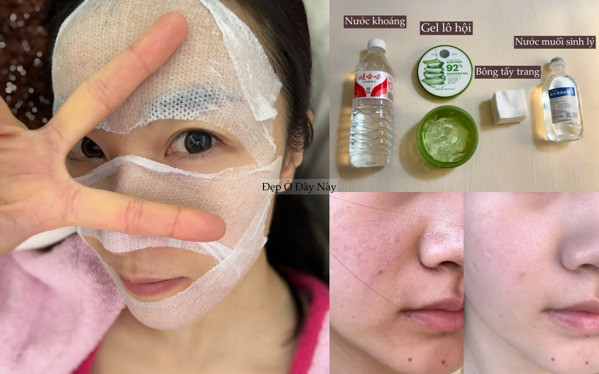 Kh&ocirc;ng d&ugrave;ng mỹ phẩm đắt tiền, tuổi 25 t&ocirc;i thu nhỏ lỗ ch&acirc;n l&ocirc;ng của m&igrave;nh nhờ 4 bước n&agrave;y!- Ảnh 1.