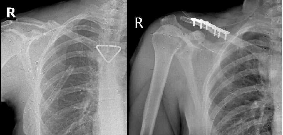 Th&ecirc;m 1 du kh&aacute;ch người Nga được b&aacute;c sĩ cấp cứu kịp thời- Ảnh 2.