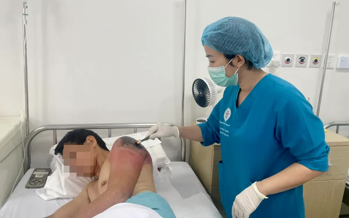 Đừng để "mẹo d&acirc;n gian" biến chấn thương nhẹ th&agrave;nh nhiễm tr&ugrave;ng nặng- Ảnh 1.